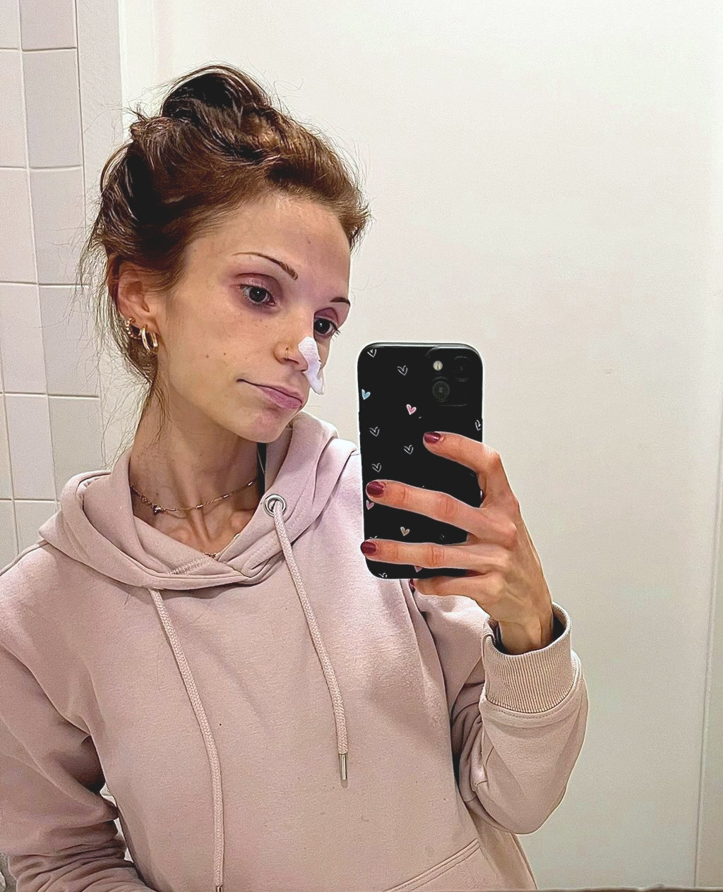 Jonge vrouw in beige hoodie maakt spiegel-selfie met smartphone, staand voor witte betegelde muur. Opname PAAZ ziekenhuis, sondevoeding, eetstoornis, anorexia, ondergewicht
